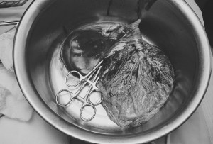 placenta b&w-